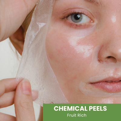 Chemical Peels