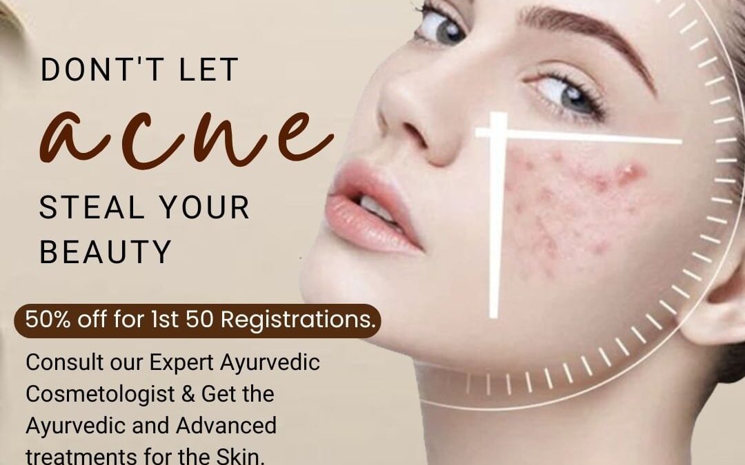 Don’t Let Acne Steal Your Beauty!