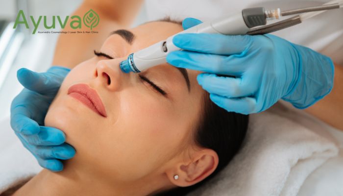 best hydrafacial in hyderabad