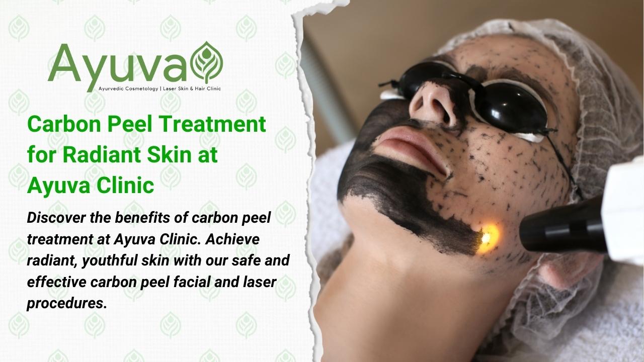 Carbon Peel Treatment at Ayuva Ayurvedic Cosmetology Skin and Hair Clinic