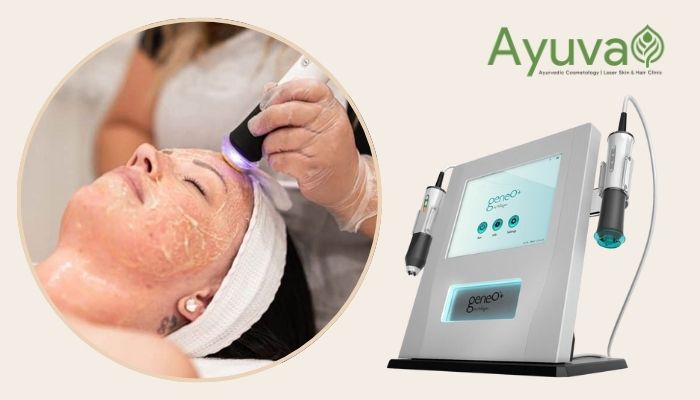 oxygeneo facial treatment