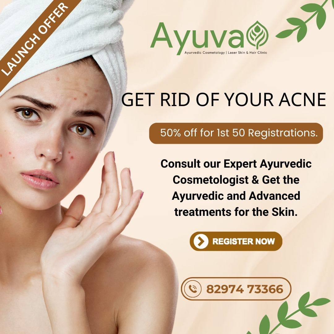 Get Rid of Your Acne!