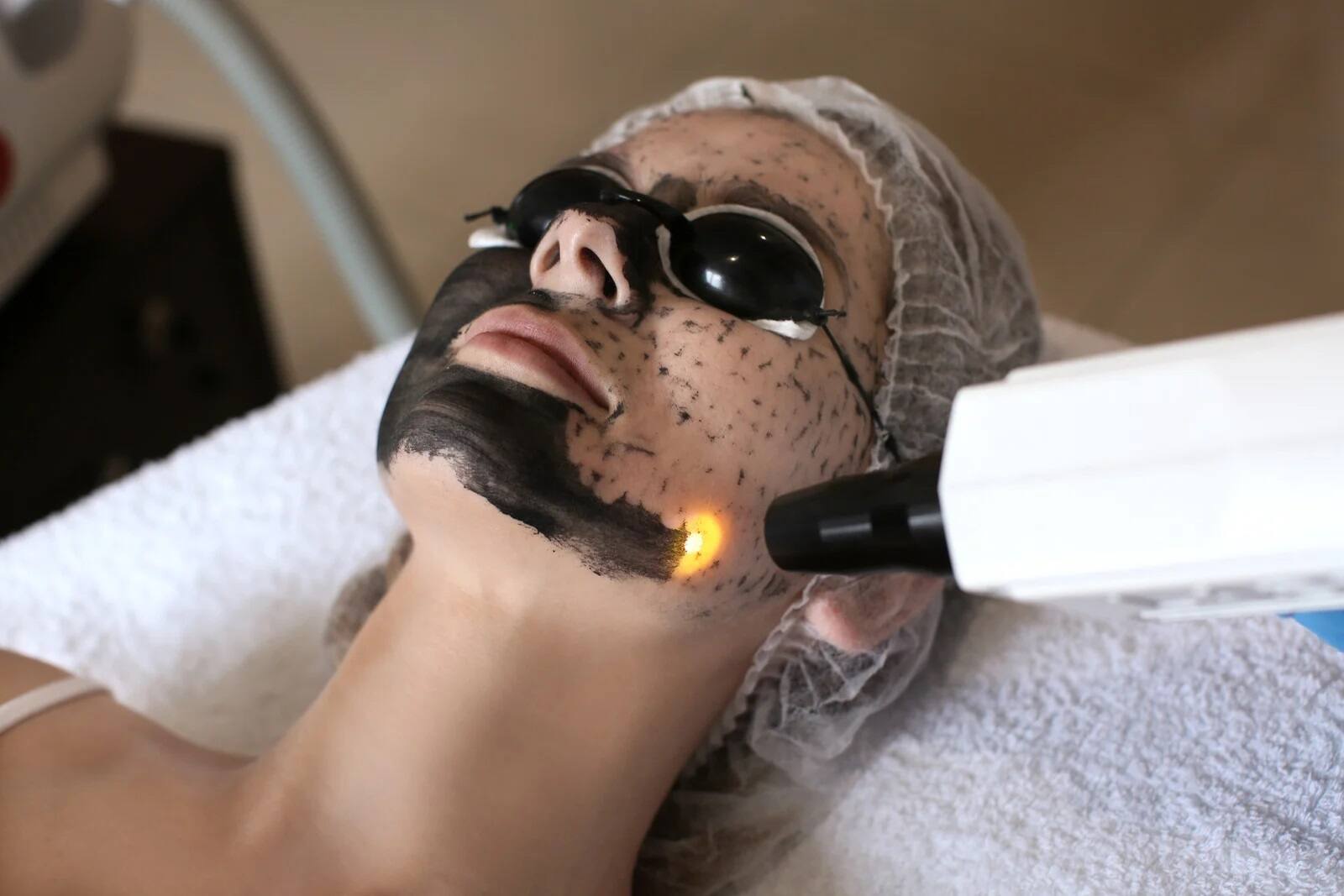 Carbon Facial Treatment in Hyderabad Carbon Facial Treatment in Hyderabad