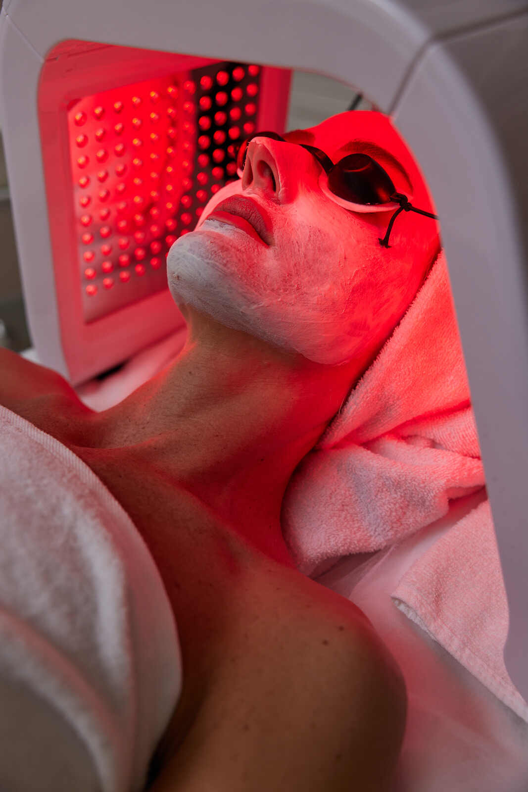 LED Light Therapy At Ayuva Skin & Hair Clinic Hyderabad