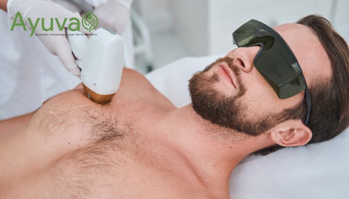 Permanent hair reduction treatments