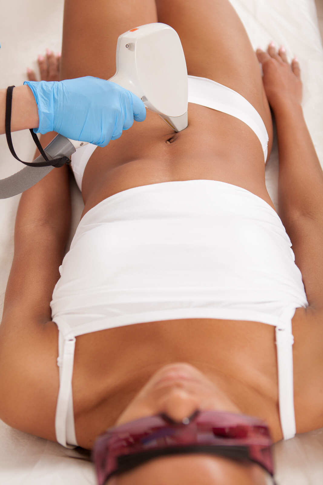 Laser Hair Removal for Abdomen