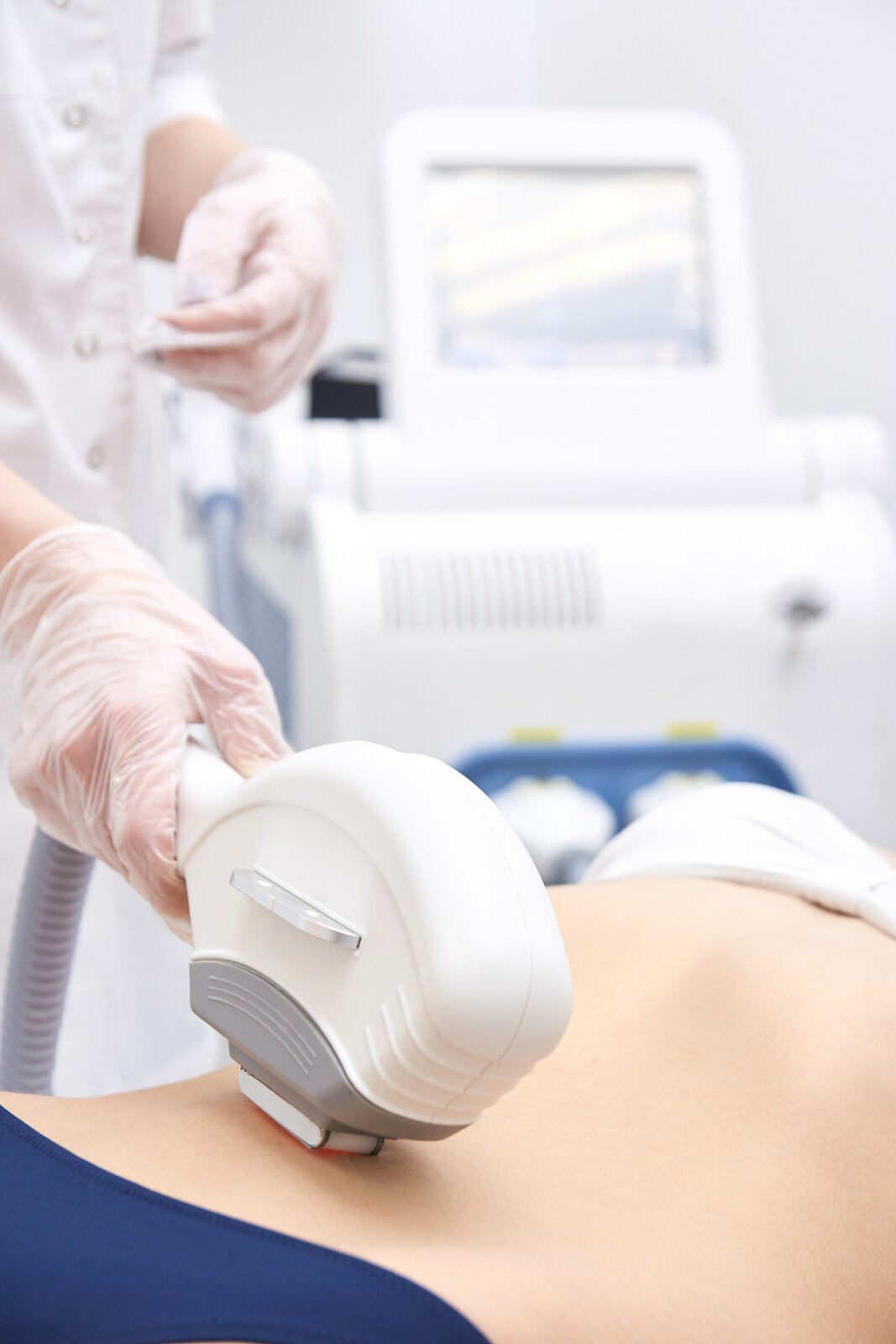 Laser Hair Removal for Abdomen