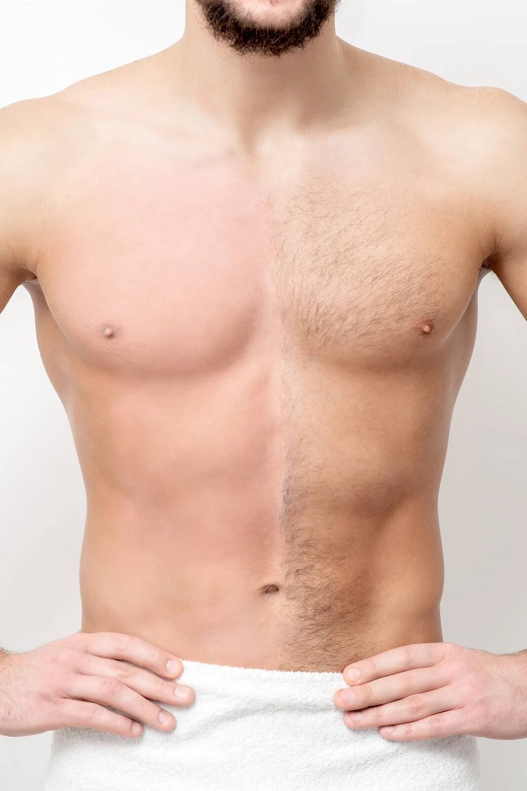 Laser Hair Removal for Chest