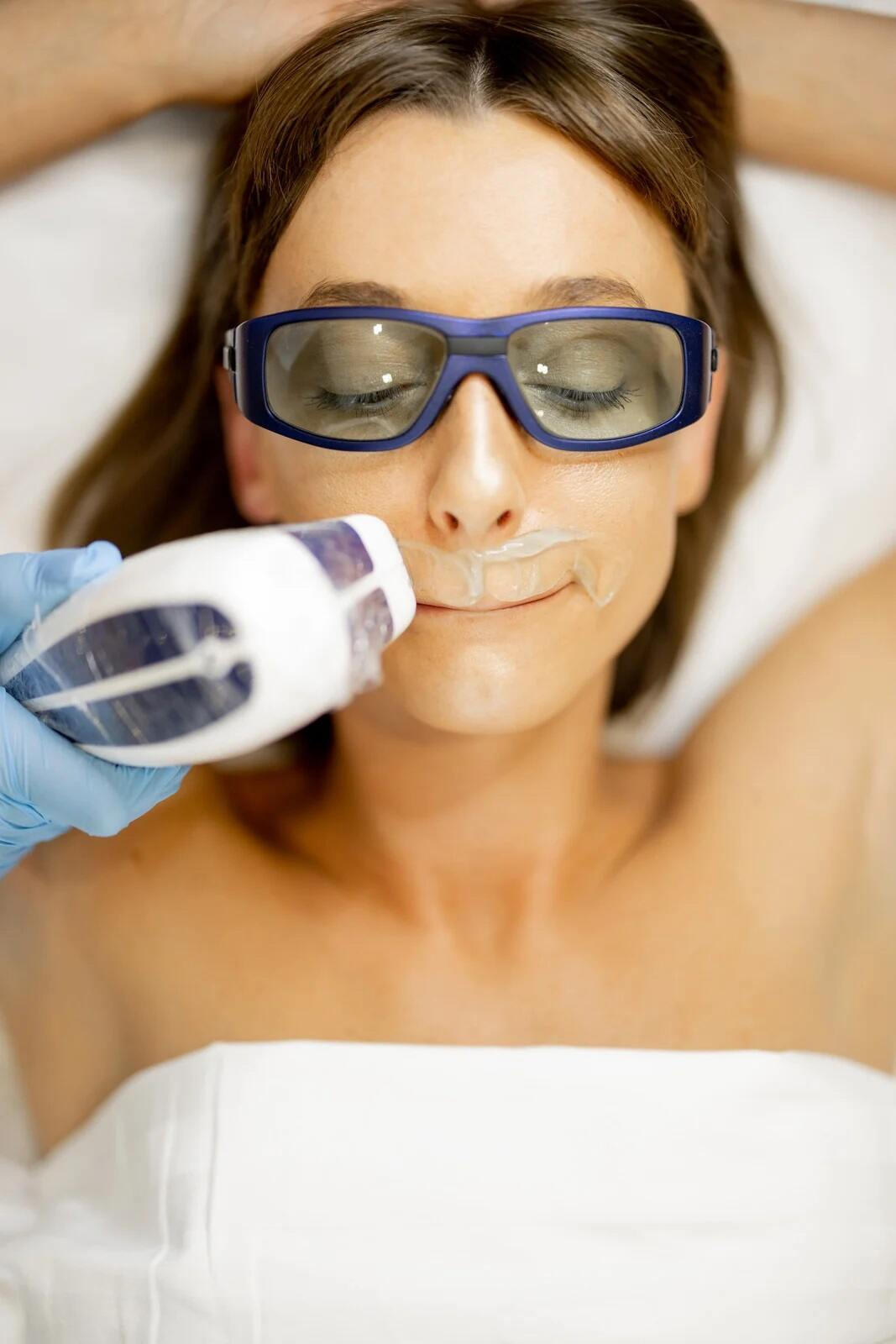 Laser hair removal treatment