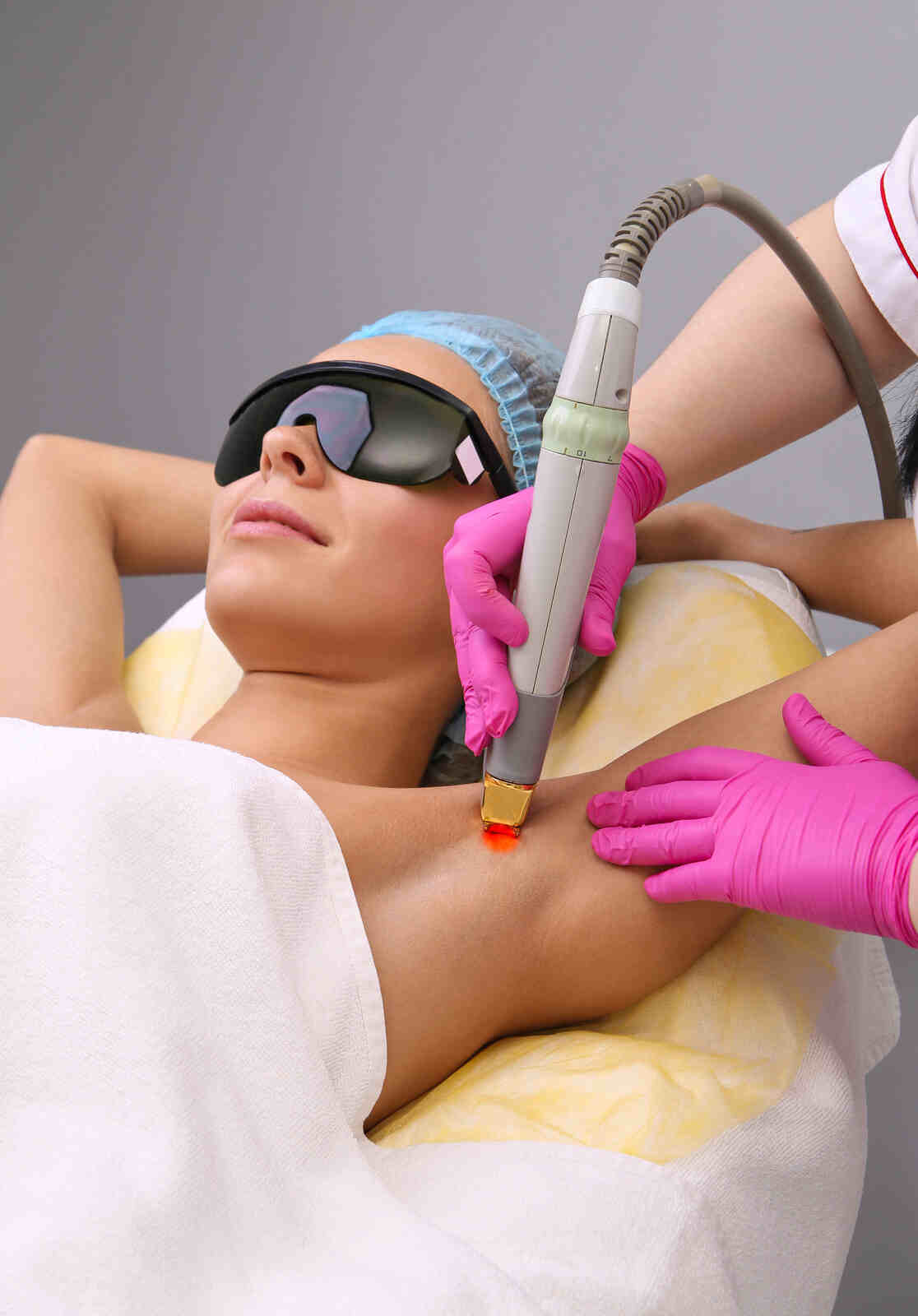 Laser hair removal treatment