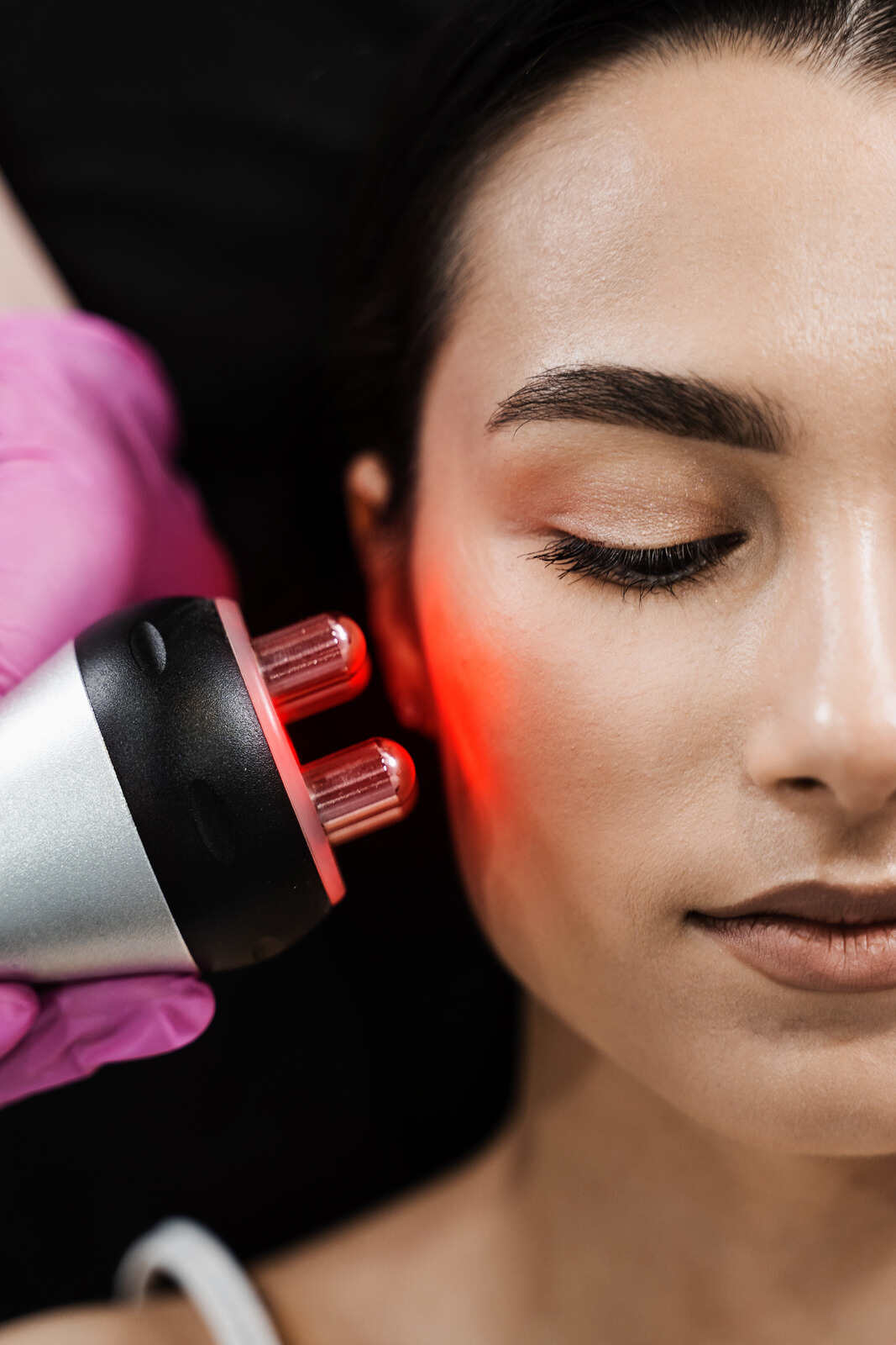 Laser Skin Tightening In Hyderabad