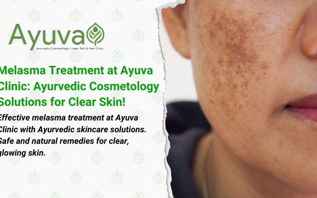 Melasma Treatment at Ayuva Clinic: Ayurvedic Solutions for Clear and Radiant Skin