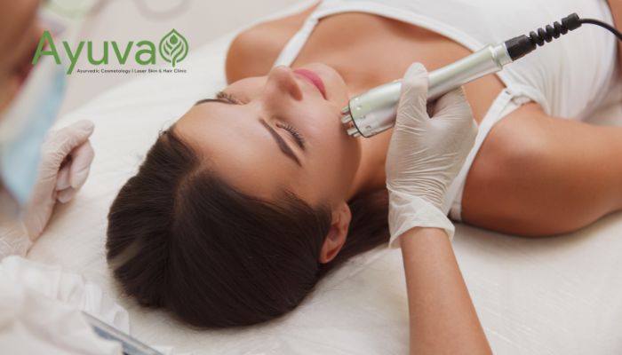 laser skin treatments